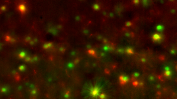 Widefield image of neurons taken by 3D-MAP