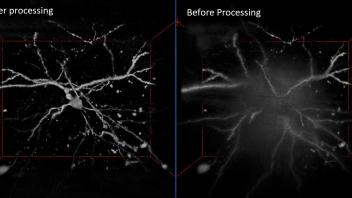 Improve image contrast by HiLL microscopy