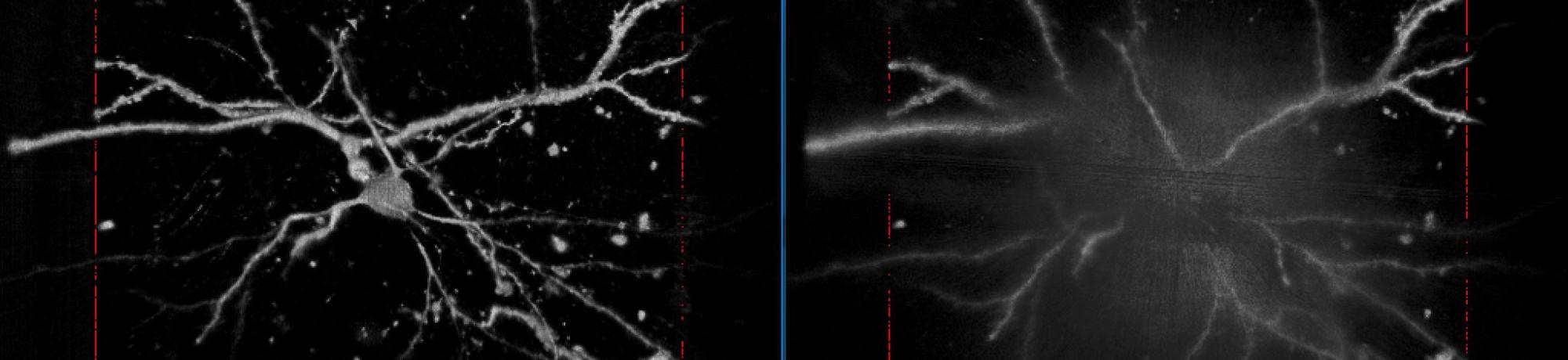 Improve image contrast by HiLL microscopy